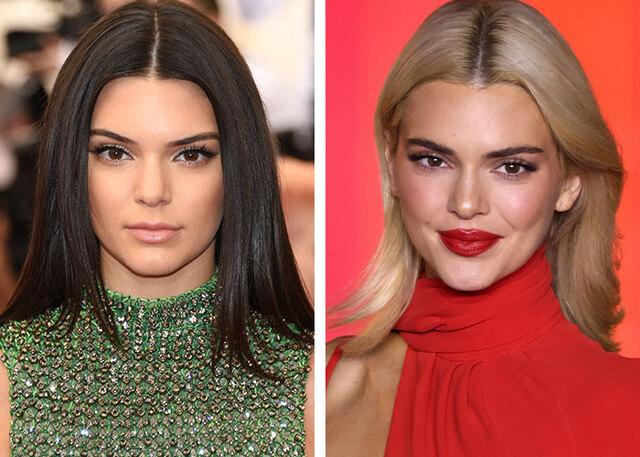 Kendall Jenner continues to deny surgery speculation, even as persistent rumors swirl.