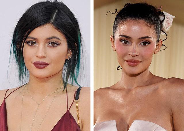 Kylie Jenner reflects with honesty on her early cosmetic choices and the regrets that followed.
