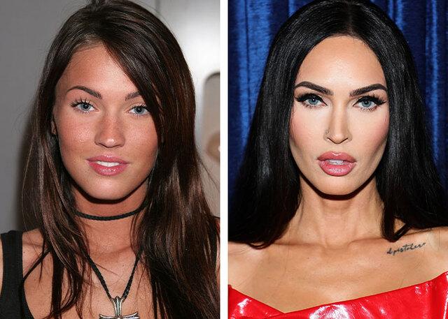 Megan Fox owns her cosmetic story, unapologetic about the enhancements she has chosen.