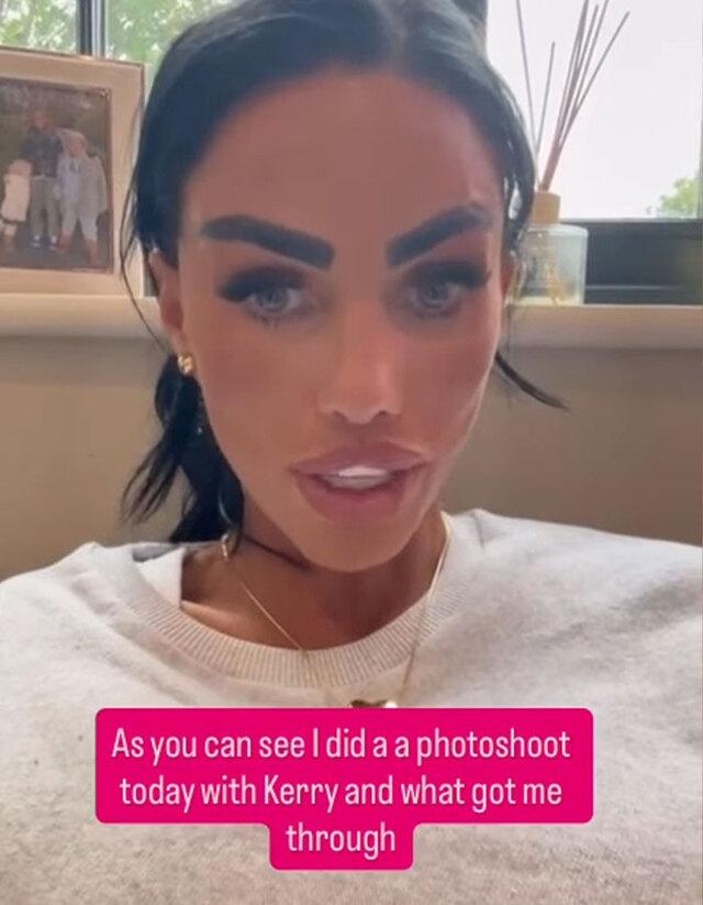 Sharing a candid update, Katie reveals how CBD oil is helping ease her pain post-procedure.