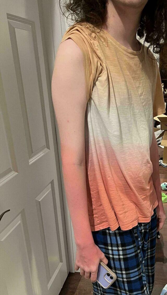 Son’s Sunburn Matching His Gradient Shirt