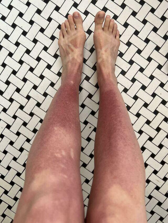 Spray Sunscreen Failure While Kayaking in Florida