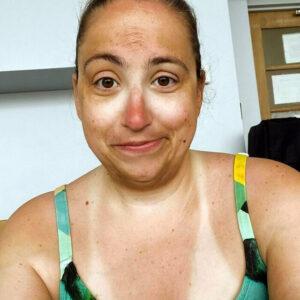 Sunglasses Left Marks After Poolside Weekend