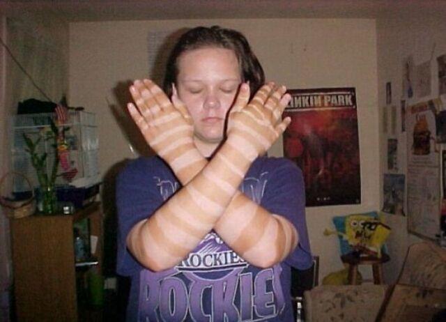 Teenager’s Tanning Foam Stripe That Lasted Months