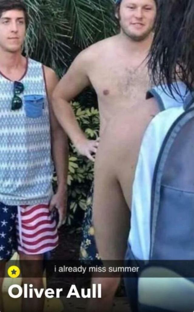 Summer Shorts Confusion: Anatomy Illu