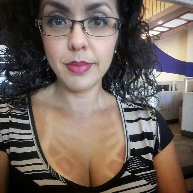 Weirdest Tan Outcome: “Now That’s Different”