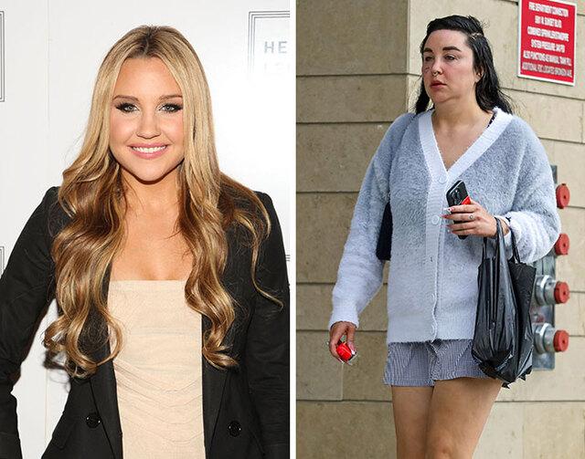 Amanda Bynes, once a beloved child star, shocked fans with her drastic changes as her struggles with mental health and cosmetic procedures came to light.