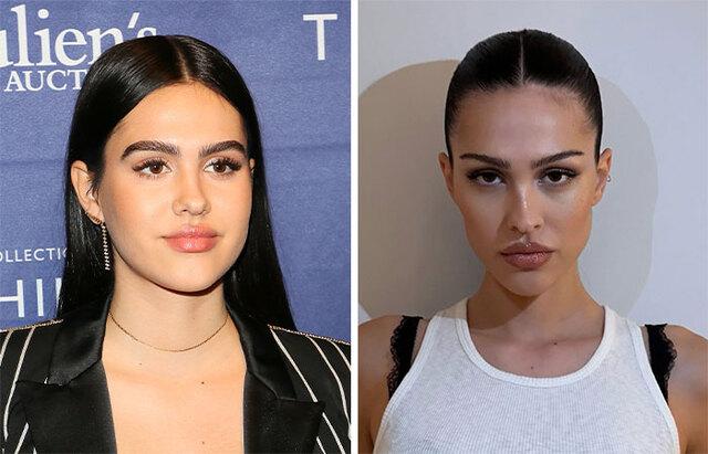 Amelia Gray Hamlin: A High-Fashion Look and Its Link to Buccal Fat Removal