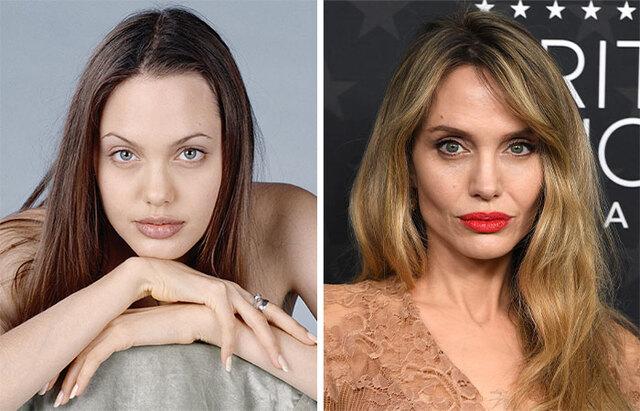 Angelina Jolie: Did the Hollywood Icon Undergo Buccal Fat Removal?
