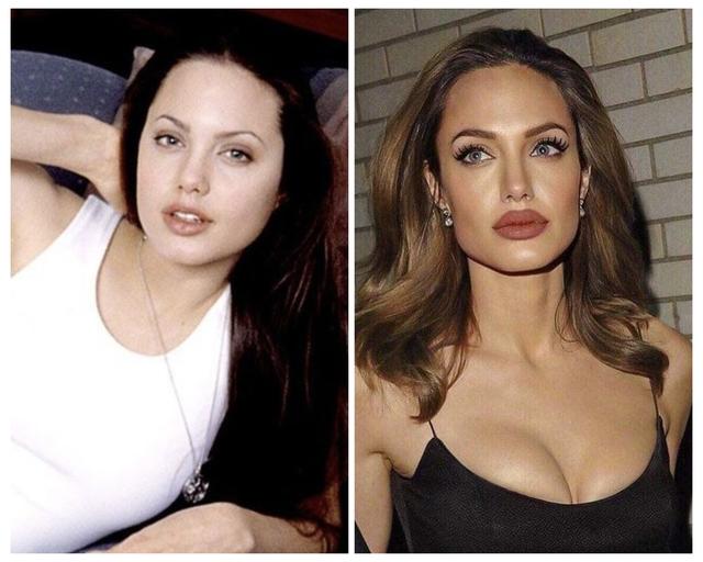 Angelina Jolie: Surgery for Health Over Aesthetics
