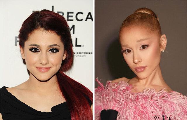 Ariana Grande: From Skeletal to Sculpted—What’s Behind the Change?