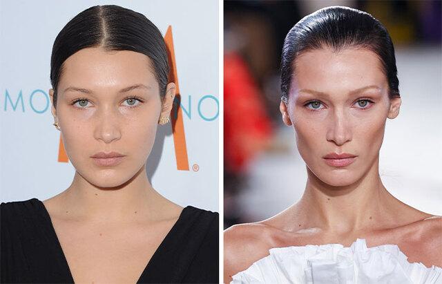 Bella Hadid: The Most Cited Example of Buccal Fat Removal
