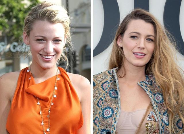 Blake Lively transformed from teen drama star to a red carpet queen admired for her fashion dominance.