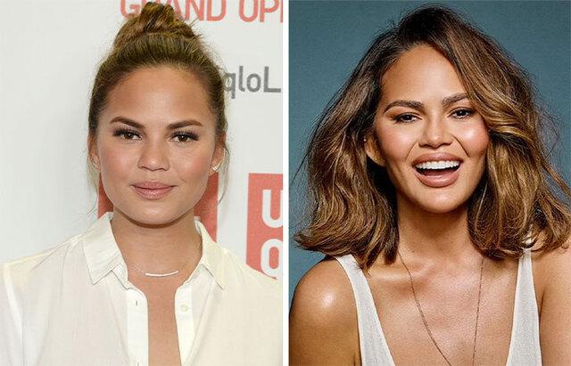 Chrissy Teigen: A Celebrity Who Openly Admitted to Buccal Fat Removal