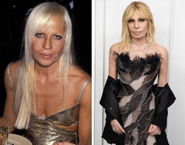 Donatella Versace has undergone one of the most visible evolutions in fashion, with her ever-changing face becoming as iconic as her brand.