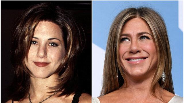 Jennifer Aniston: Subtle Enhancements and Timeless Beauty