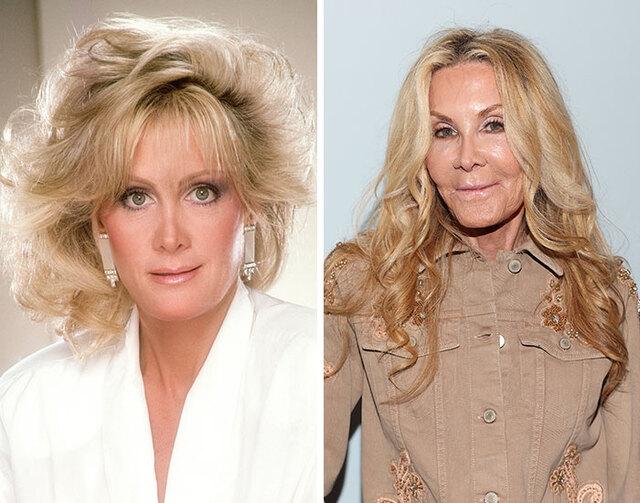 Joan Van Ark, once admired for her natural beauty on Knots Landing, is now remembered for the frozen expressions caused by years of cosmetic enhancements.