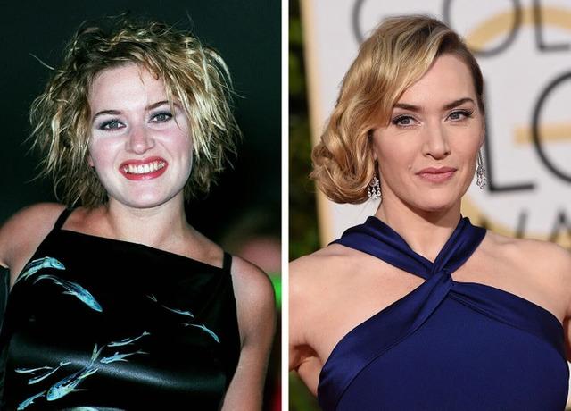 Kate Winslet proved that true transformation lies in embracing natural elegance and self-love.