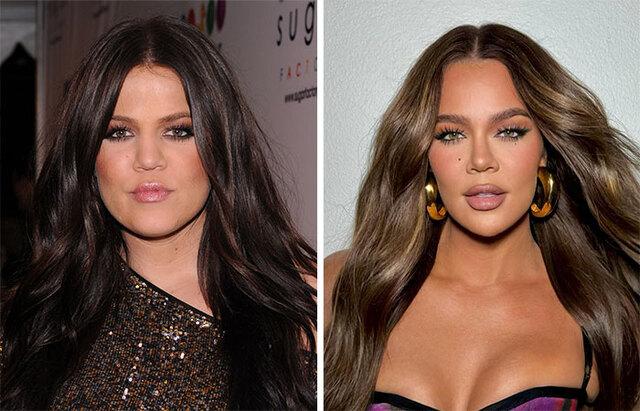 Khloe Kardashian: The Kardashian Family and Cosmetic Surgery Rumors