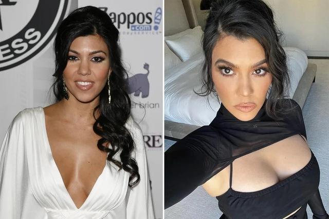 Kourtney Kardashian: From Cosmetic Procedures to Natural Beauty
