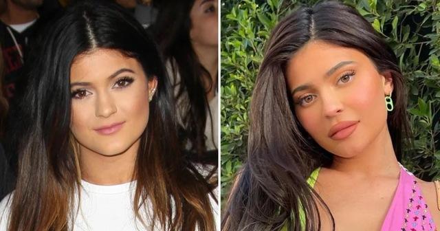 Kylie Jenner: The Business of Transformation
