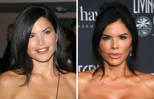 Lauren Sanchez: The Transformation Under the Spotlight
