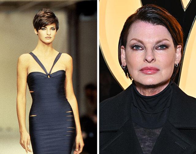 Linda Evangelista bravely revealed how a CoolSculpting mishap tragically altered her appearance, making her a symbol of the risks behind beauty treatments.