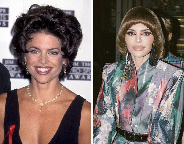 Lisa Rinna admitted that she regretted her overfilled look, proving that even reality stars can learn hard lessons from cosmetic enhancements.