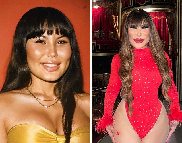 Lyn May went from celebrated Mexican vedette to a heartbreaking example of botched injections after a procedure left her permanently scarred.