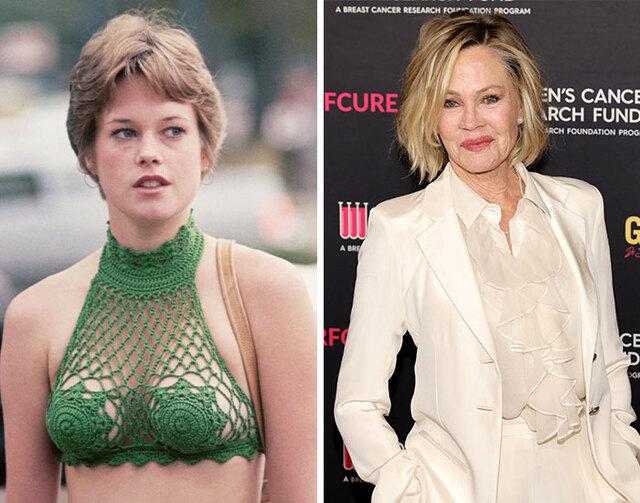 Melanie Griffith admitted to regretting her cosmetic procedures, choosing recovery and self-acceptance after years of public scrutiny about her changing face.
