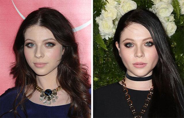 Michelle Trachtenberg: The Sad Truth Behind Her Facial Transformation