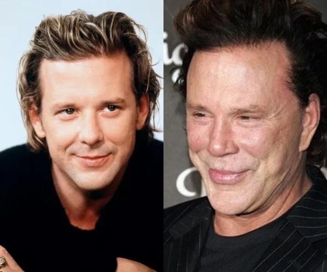 Mickey Rourke: The Double-Edged Sword of Cosmetic Surgery