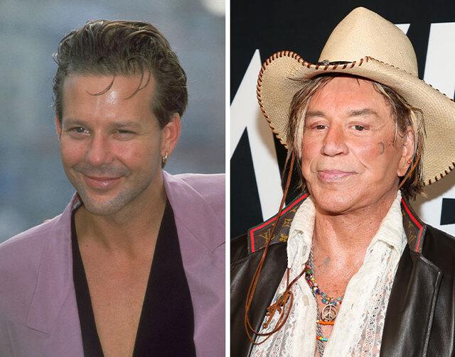 Mickey Rourke, once known for his rugged good looks, paid the price of reconstructive surgery after years of brutal boxing injuries left lasting marks.