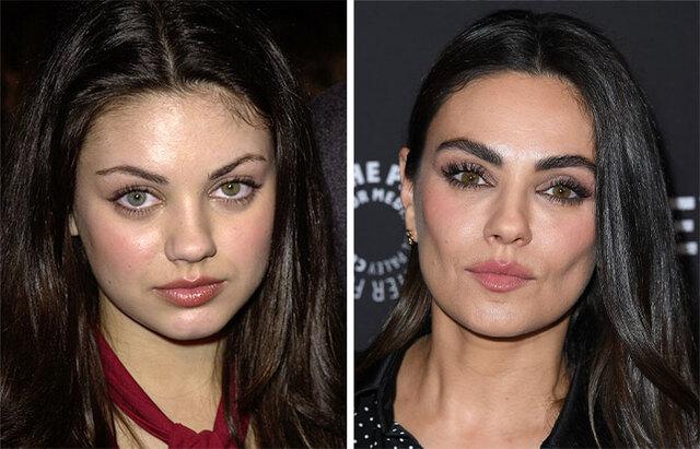 Mila Kunis: Aging Gracefully or Cosmetic Surgery?