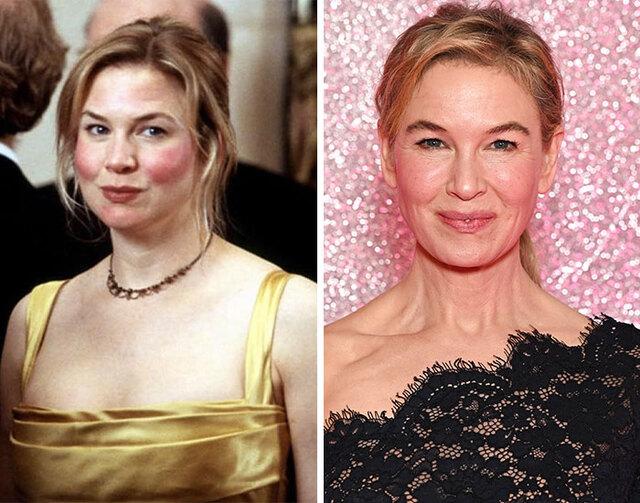 Renée Zellweger stunned the world with her red-carpet reveal, where her drastically altered face made fans question whether they were seeing the same actress.