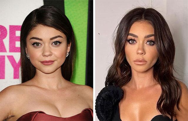 Sarah Hyland: Changes Due to Health or Surgery?