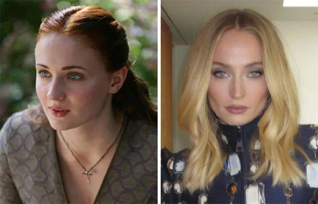 Sophie Turner: A Transformation That Was More About Health Than Beauty