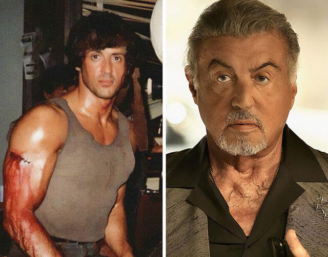 Sylvester Stallone, the face of Rocky and Rambo, has seen his rugged features shift through surgical tweaks that softened his once-tough exterior.