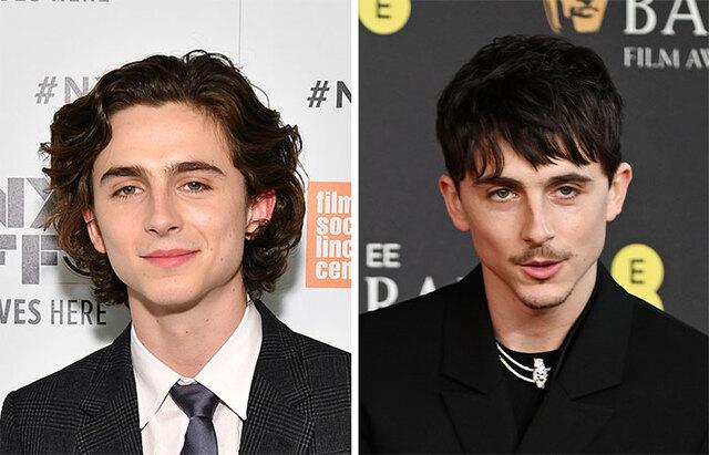 Timothée Chalamet: The Unexpected Male Celeb Linked to Buccal Fat Removal