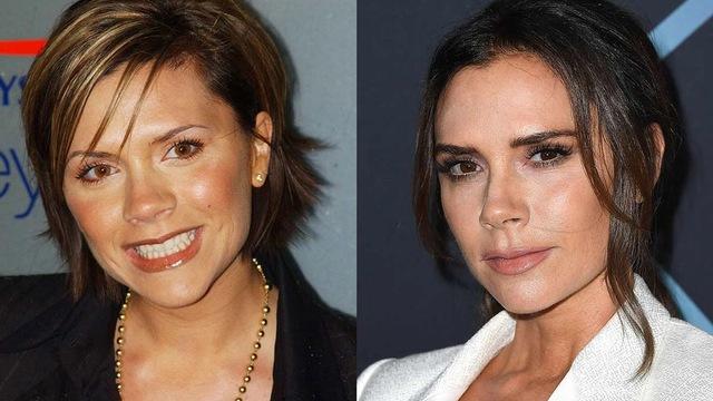 Victoria Beckham: Evolving Beauty Standards