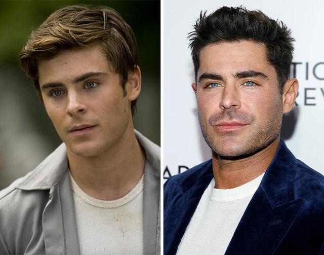 Zac Efron’s drastic change was not vanity but survival, as reconstructive surgery following a devastating jaw injury forever reshaped his appearance.