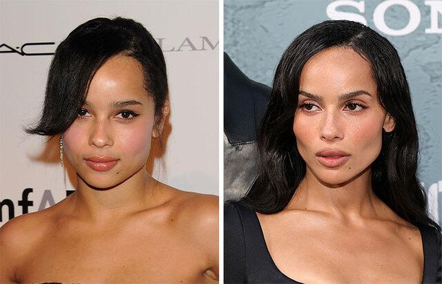 Zoe Kravitz: Sharp Features That Fuel Buccal Fat Removal Rumors