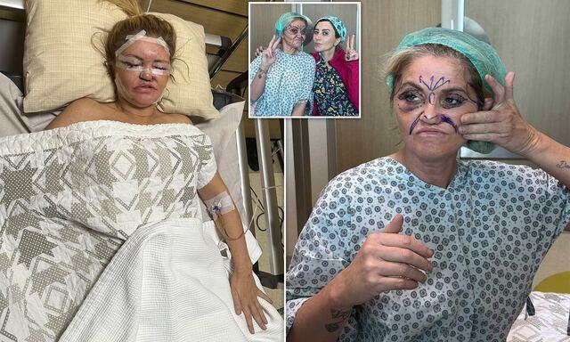 Over the years, Danniella’s appearance changed dramatically.