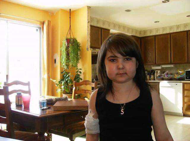 Diagnosed with ulcerative colitis at the age of three and later progressing to Crohn’s by 11, Sara’s early years were defined by constant pain