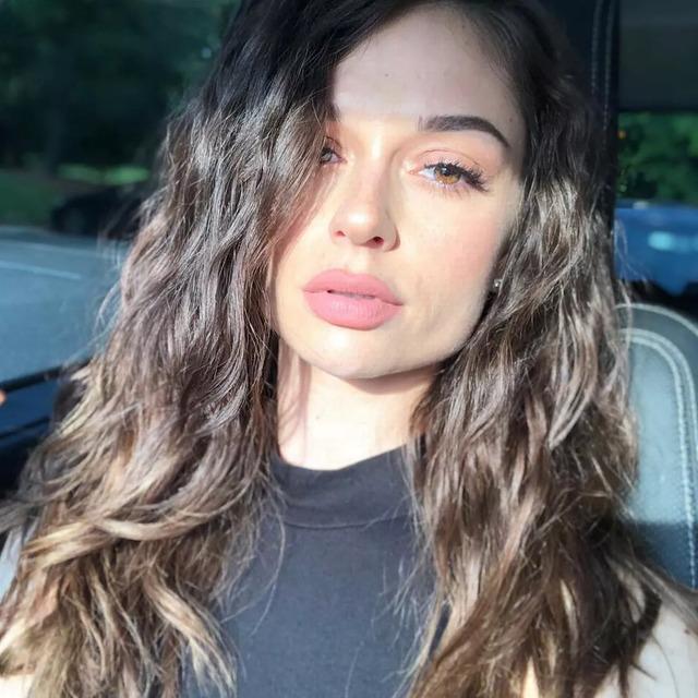 It took almost 20 years for Tessa to fully accept her prosthetic leg and all that it represented.