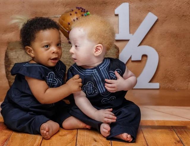 The twins wear traditional attire, embodying their cultural heritage while showcasing their unique bond.