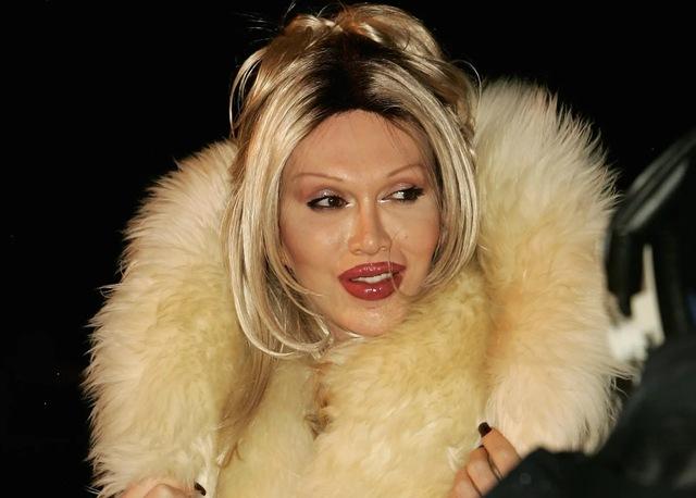 Burns began undergoing multiple surgeries to alter his appearance.