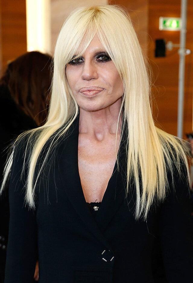 In Donatella’s case, the overuse of cosmetic enhancements resulted in a face that looked overly sculpted