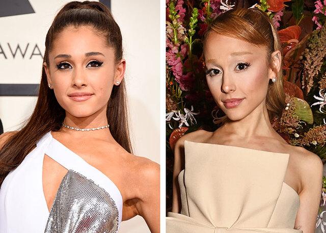 Ariana Grande revealed she stopped using Botox and fillers years ago to embrace her natural aging process.