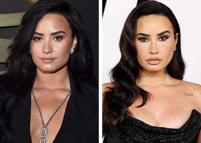 Demi Lovato is open about her use of injectables to help take the taboo out of cosmetic maintenance.